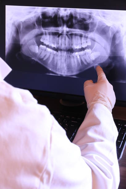 Best Emergency Tooth Extraction in Highwood, IL