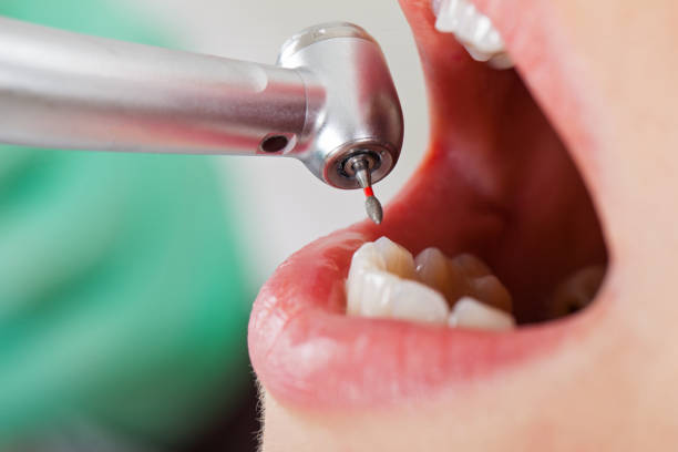 Best Emergency Treatment for Dental Infections or Abscesses in Highwood, IL